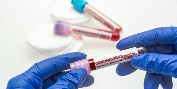 Koronavirüs tablosu açıklandı Düşüş devam ediyor!